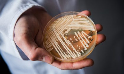 Candida auris: l’ultimo spauracchio del fungo che uccide in tre mesi