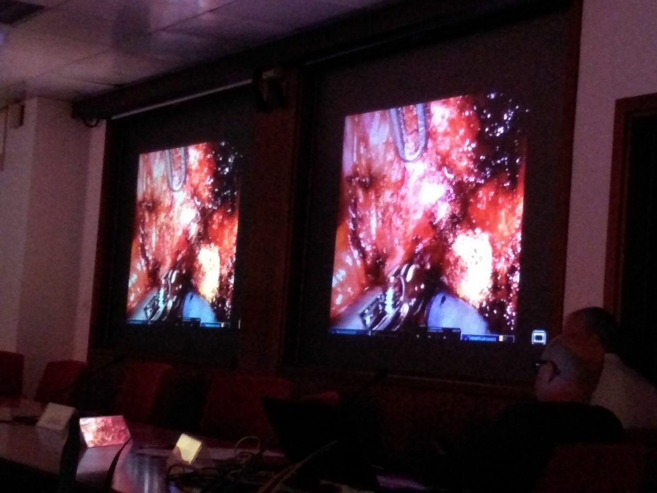 Chirurgia robotica al Ca’ Foncello di Treviso