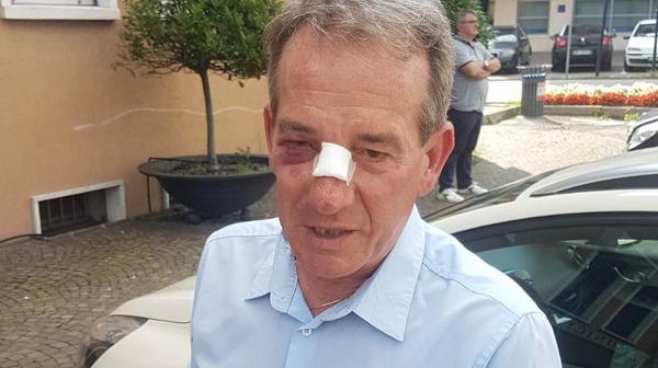 Fermati i presunti aggressori del sindaco di Caerano
