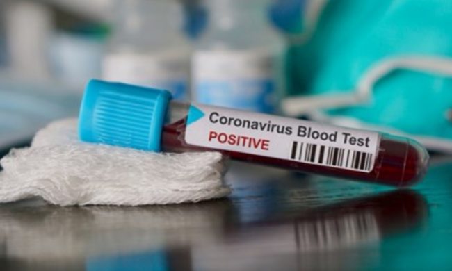 Positivi Coronavirus per comune: sospeso l’invio dei dati ai sindaci