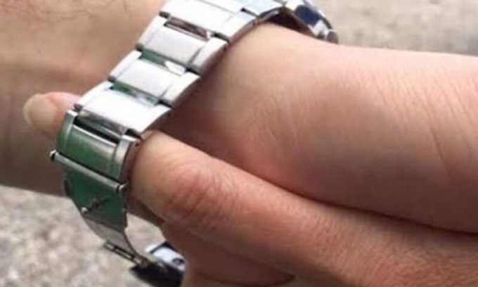 Avvicina un anziano con una scusa, gli strappa l’orologio (di lusso) e gli ferisce una mano