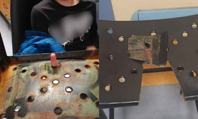 Bimbo si incastra un dito nel foro di uno sgabello in ferro, per liberarlo… intervengono i vigili del fuoco